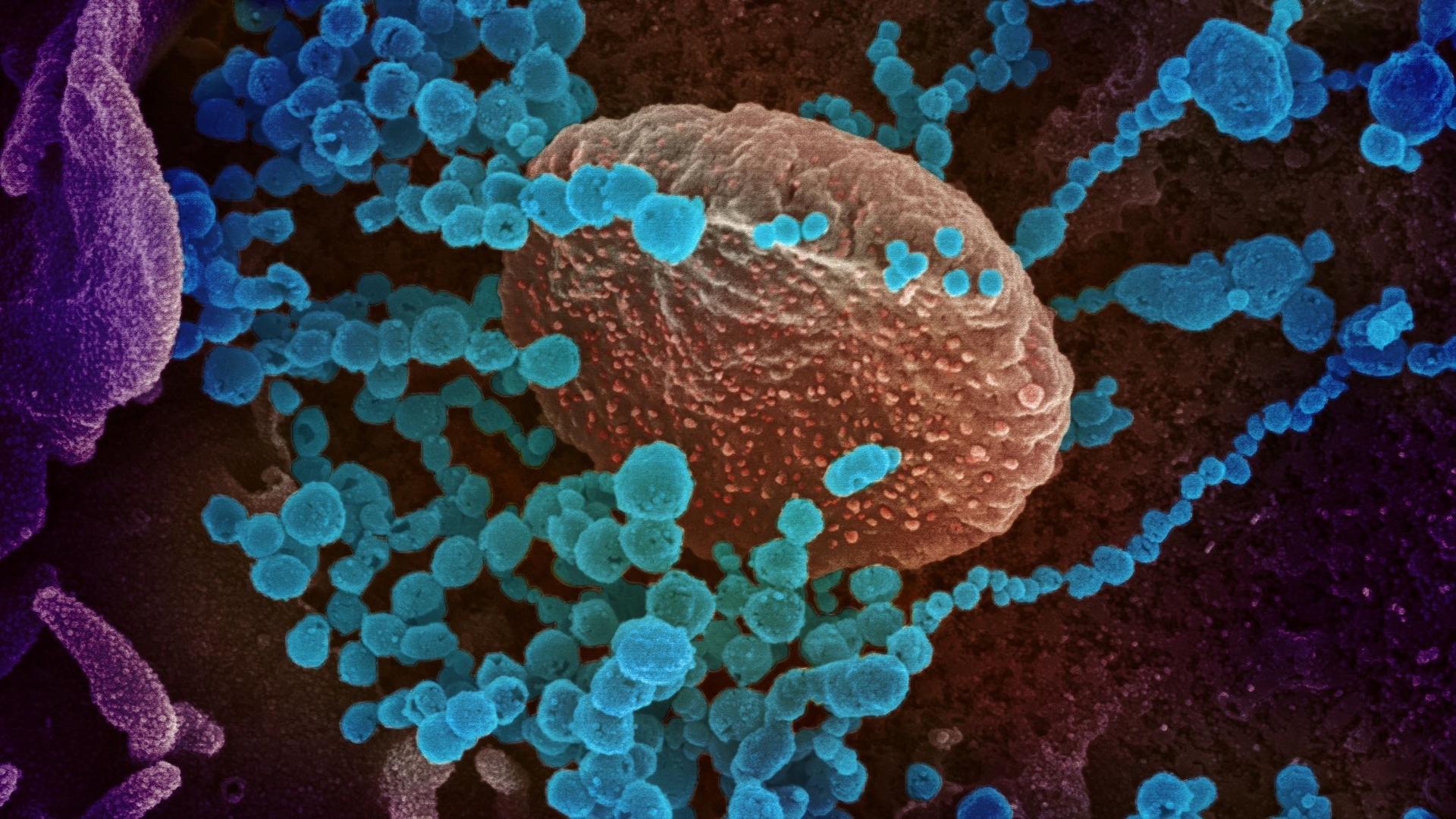 This scanning electron microscope image shows SARS-CoV-2 (round blue objects), also known as the novel coronavirus, the virus that causes COVID-19, emerging from the surface of cells cultured in the lab which was isolated from a patient in the US. 