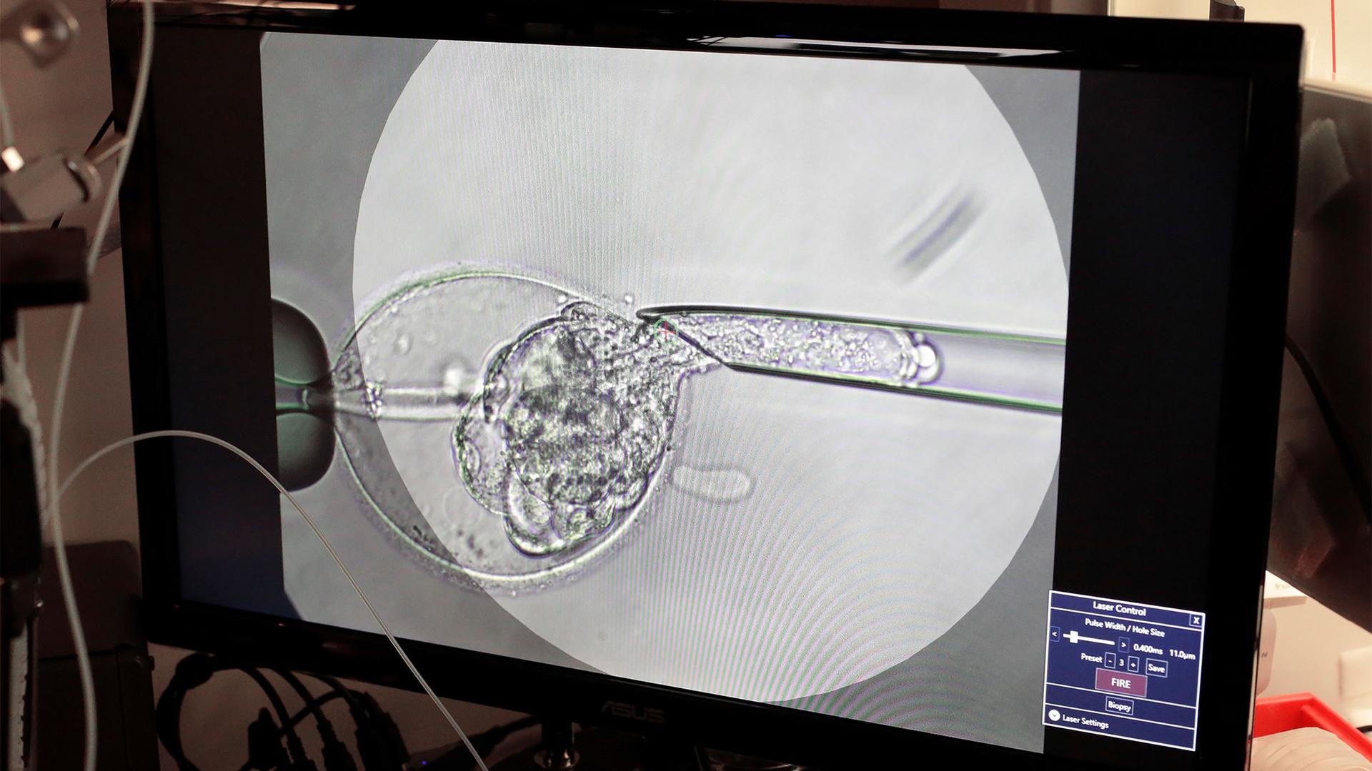 A view of the process on a montior as lab staff use a microscope stand and articulated hand controls to extract cells from 1-7 day old embryos that are then checked for viability at the Aspire Houston Fertility Institute in vitro fertilization lab in Hous